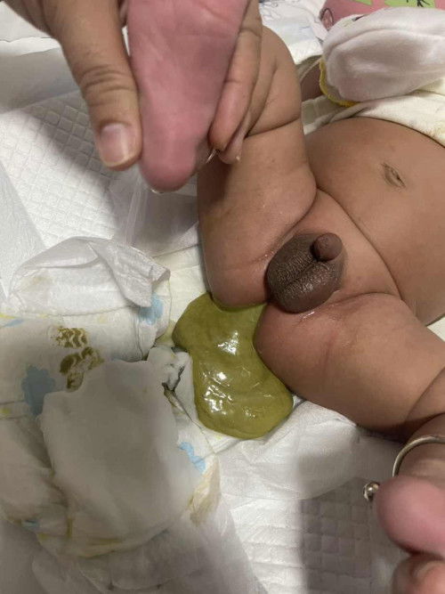 ลูกอายุ1เดือน 12 วัน