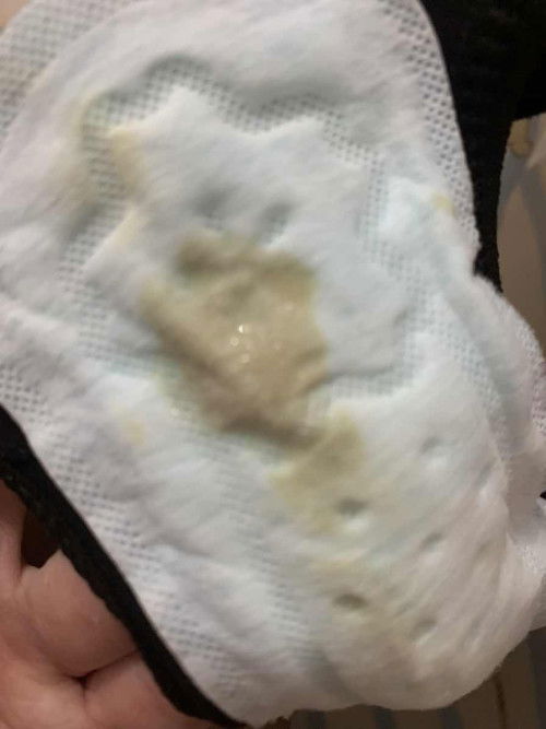 ท้องแรกค่ะ อายุครรภ์ 37+2วัน