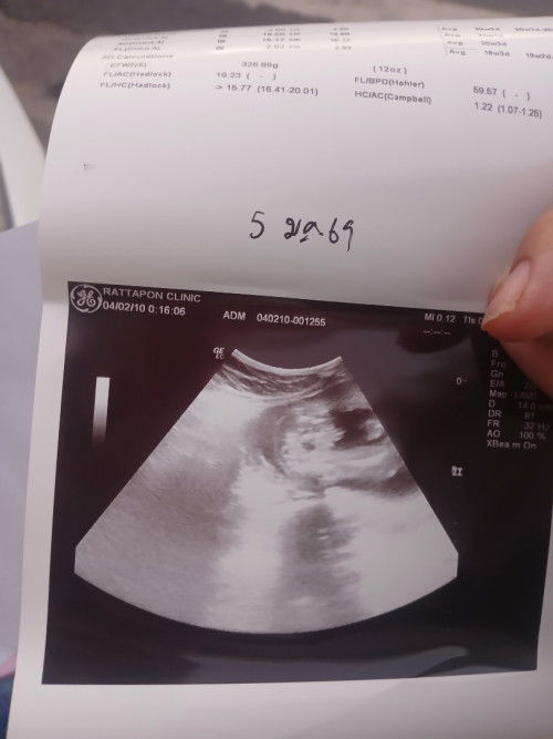 มาทายกันจ้า