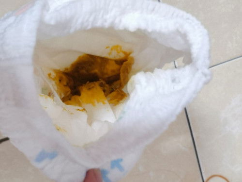 Usia 14 bulan bab benyek berteksur berkali2