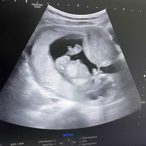 ภาพอัลต้าซาว