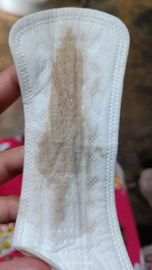 hi po, ask ko lang po sana if normal po ba ito 31 weeks preg po.pasintabi po sa picture.thank you.