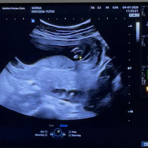 แม่ทีมกรกฏาคม