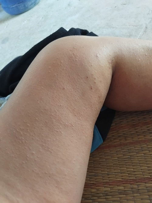 แม่ๆบ้านไหนเป็นแบบนี้บ้างคะ