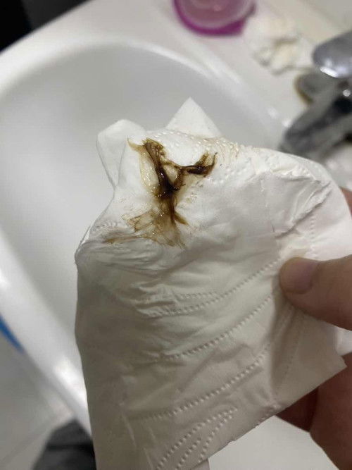 สอบถามหน่อยค่ะ 12 สัปดาห์แล้วมีมูกแบบนี้ออกมาอันตรายไหมคะ