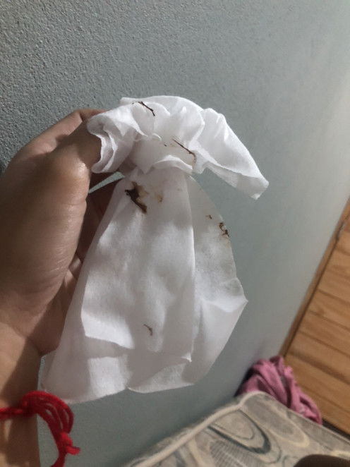 อายุครรภ์39+2