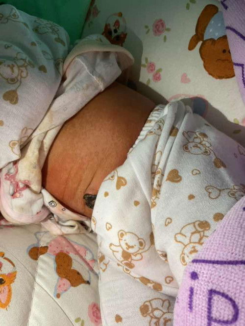 ตรงท้องน้องเป็นแบบนี้น้องเป็นอะไรคะ