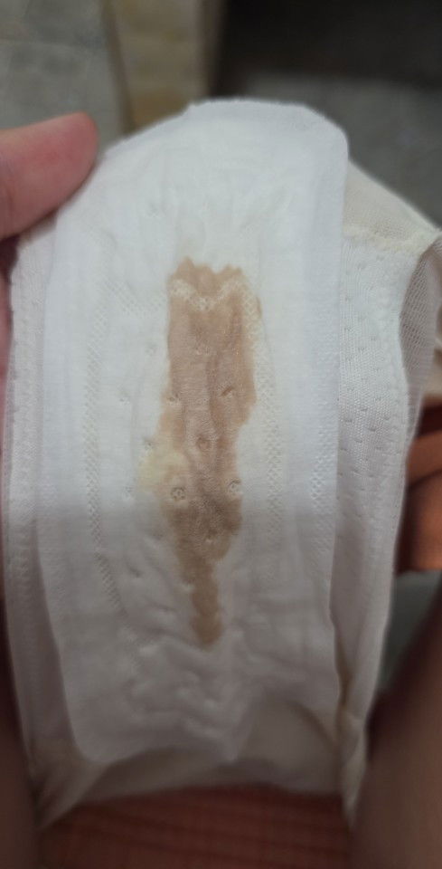 เลือดออกใช่เลือดล้างหน้าเด็กมั้ยคะ