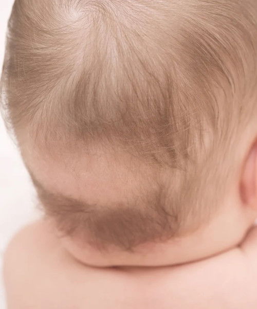 Hair loss on baby