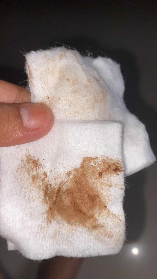 hamil 39 week Setelah HB keluar darah dan flak kecoklatan