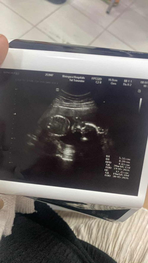 สวัสดีค่ะแม่ ๆ อยากสอบถาม