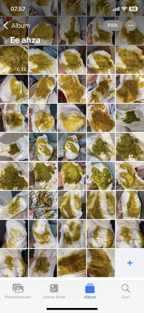 Bab bayi, apakah normal?