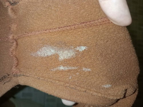 Milky white Discharge