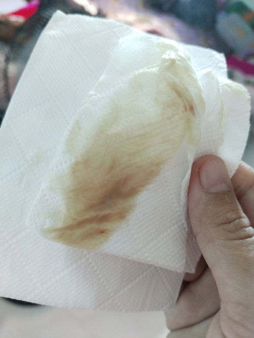 ตกขาวปนเลือด