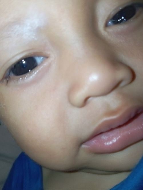 Mau sembuh atau harus ke Dsa