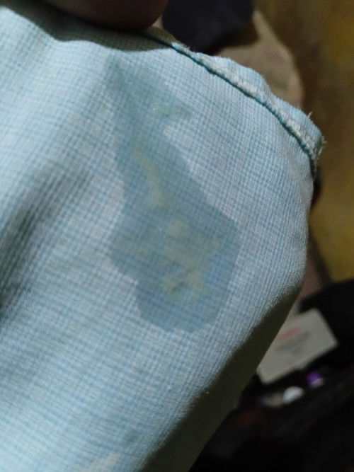 ini keputihan atau air tuban