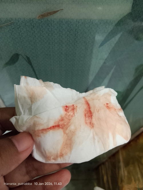 masa nifas sudah 40 hari lebih tapi masih kluar lendir seperti itu aman atau tidak ya?mohon infonya