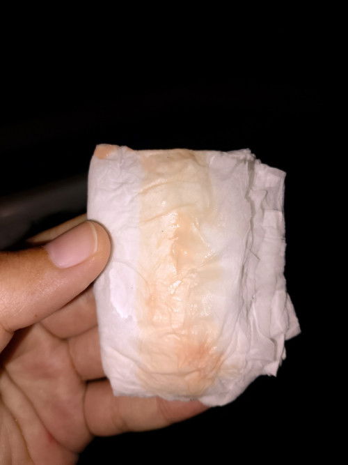 37+3สัปดาห์