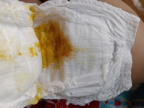 เด็ก2เดือน