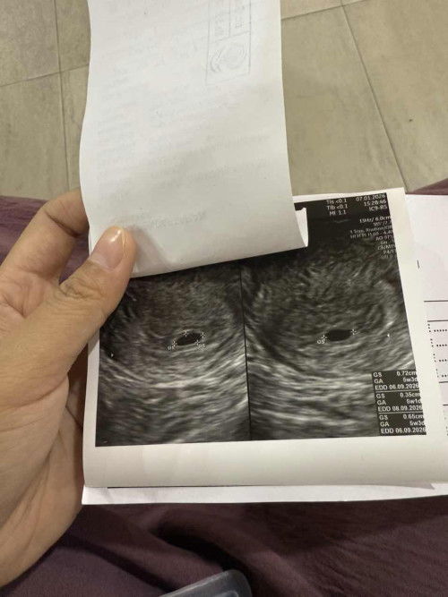 Hpht 5 desember 2025