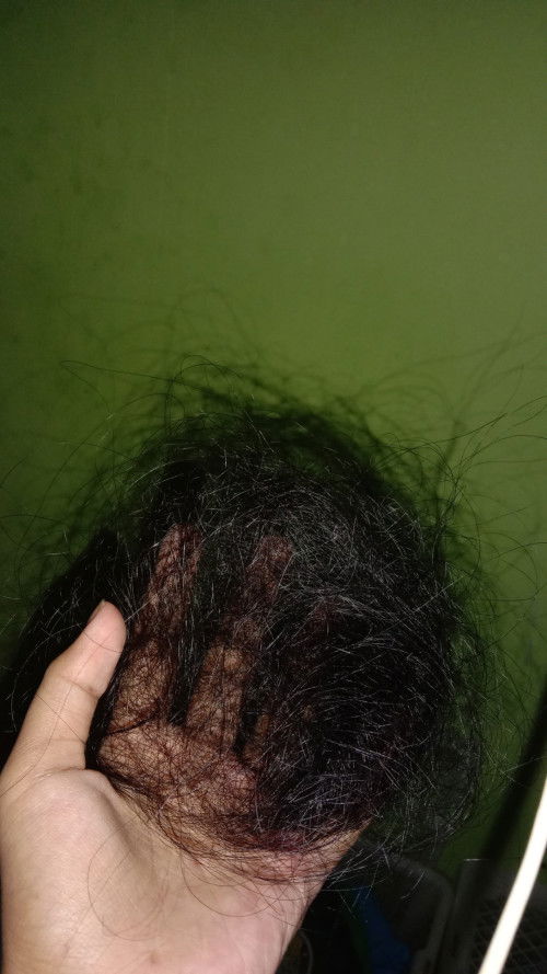 Maaf kalo ga sesuai sama apk nya, rambut rontok berlebihan knpa ya?setiap nyisirin psti rontok bnyak