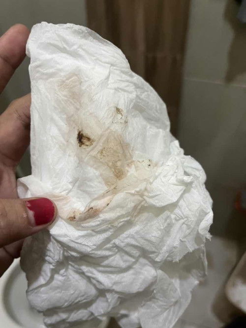 Keluar bercak coklat