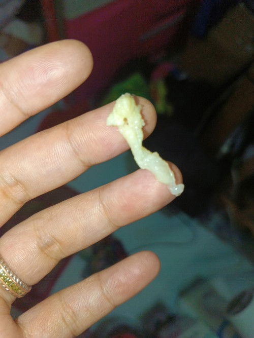 Normal discharge po ba to?
UTZ FEB 13
LMP JAN 30

Sumasakit likod at puson