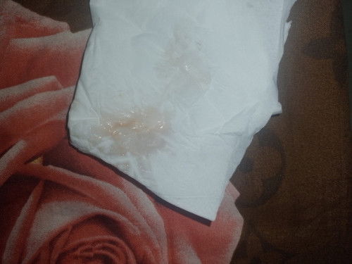 Keluar keputihan warna pink dikehamilan 6w