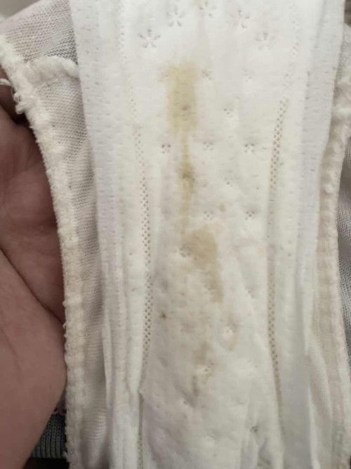 Darah nifas atau keputihan?