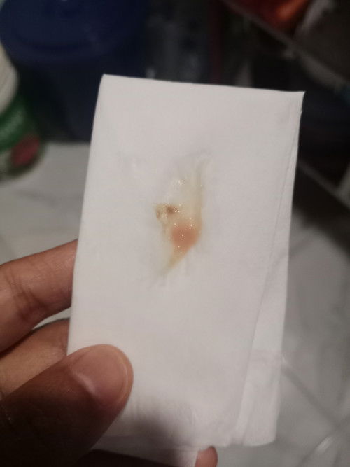 Lendir kecoklatan kehamilan 8 minggu