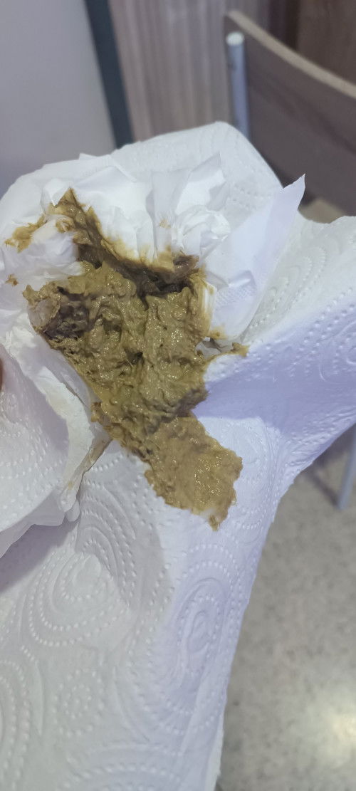 สีอึทารก..