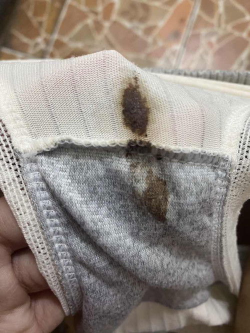 ตกขาวเป็นแบบนี้อันตรายไหมคะพอดีตั้งครรภ์ครั้งแรกได้27วีคแล้ว