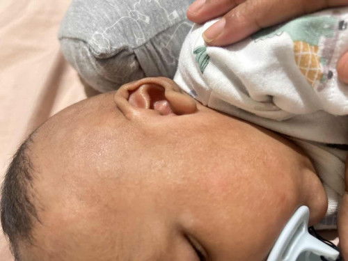 baby skin ( isit bcus of milk?)