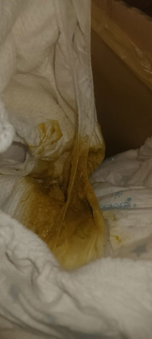 น้องท้องเสียคะ