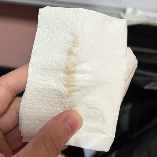 แบบนี้จะคลอดหรือยังคะ