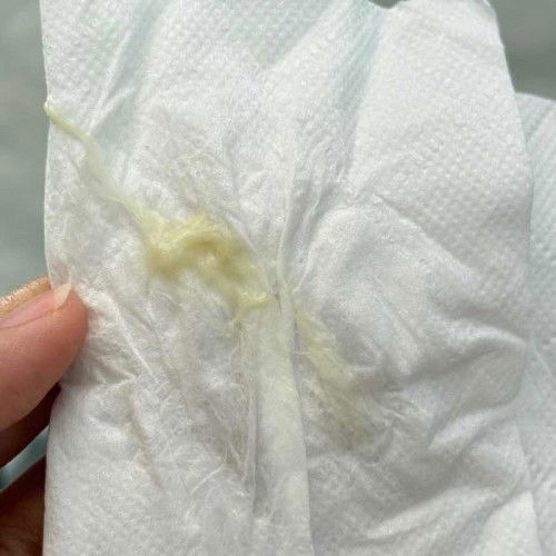 ท้องแรก  29+4 สัปดาห์