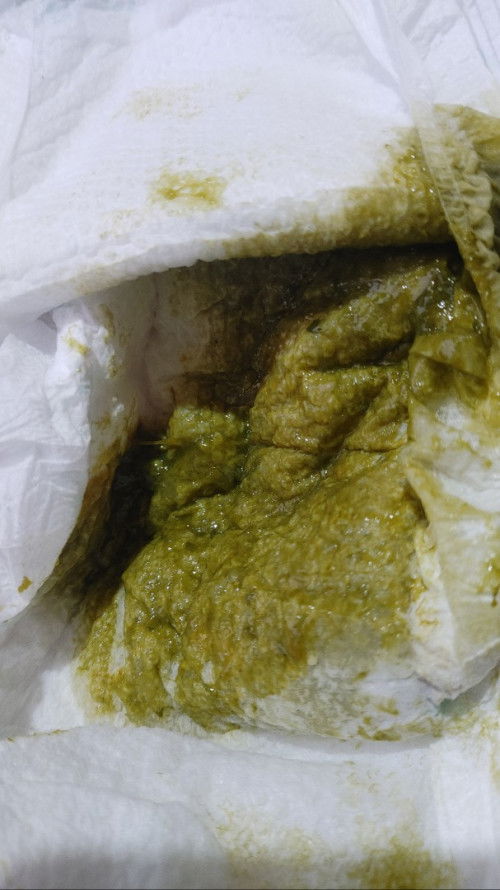 Normal po ba poop ni baby or Sign po ba ito ng diarrhea? 
11 months old baby