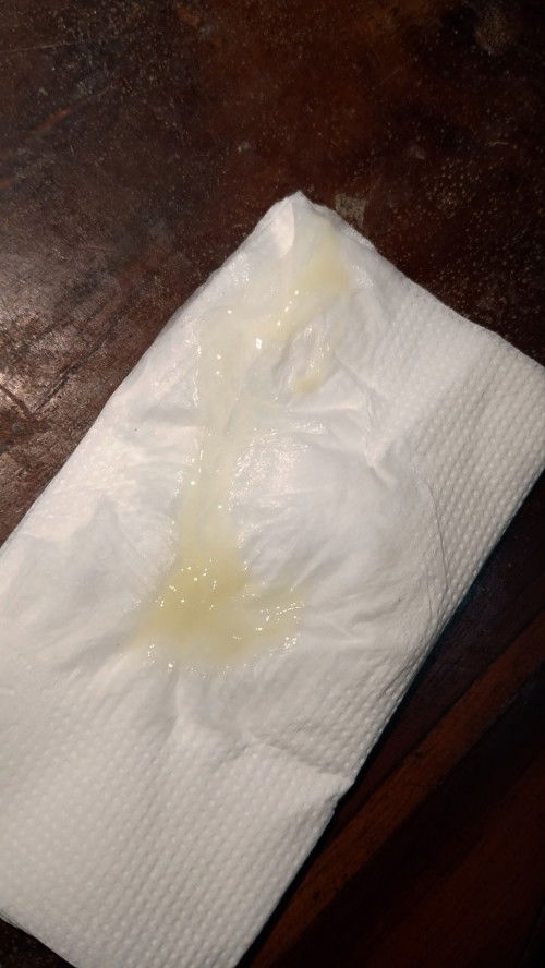 Apakah ini mucus plug?