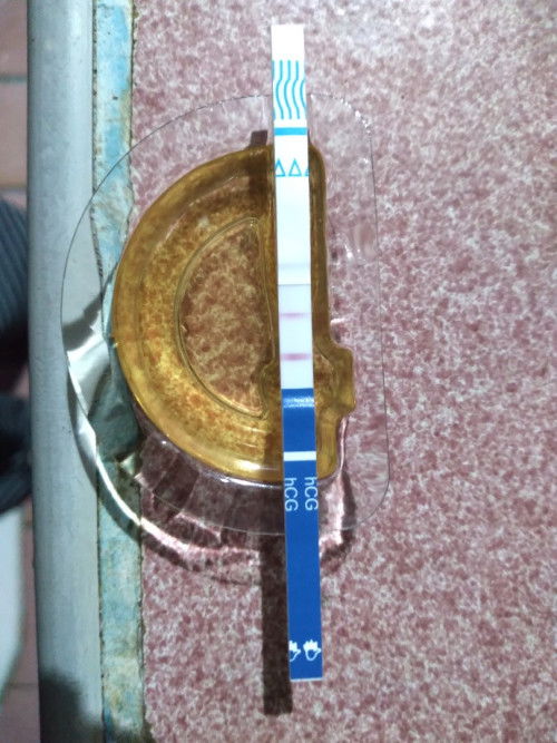 แบบนี้ท้องไหมค่ะ