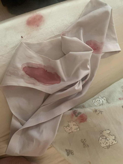 Nalaglag na po ba ito?