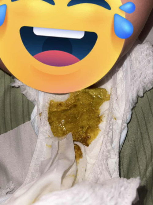 แบบนี้คืออึปนมูกเลือดมั้ยคะ