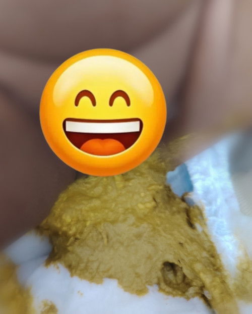 BABY 1 BULAN 14 HARI MASALAH BERAK