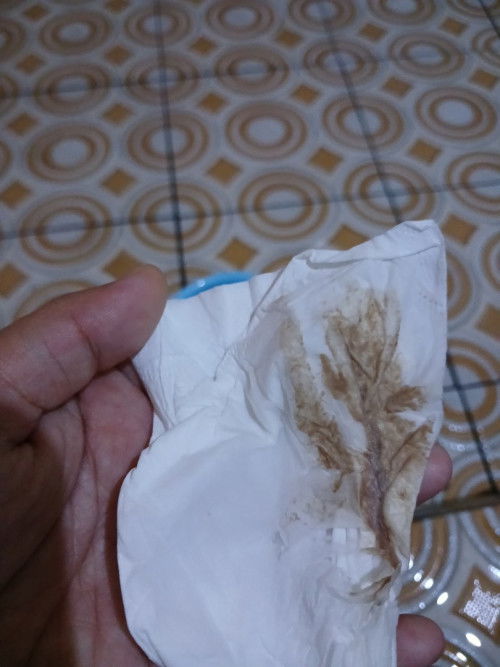 tanda persalinan bukan