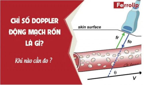 Chỉ số Doppler động mạch rốn PI là gì? Bao nhiêu là bình thường?
