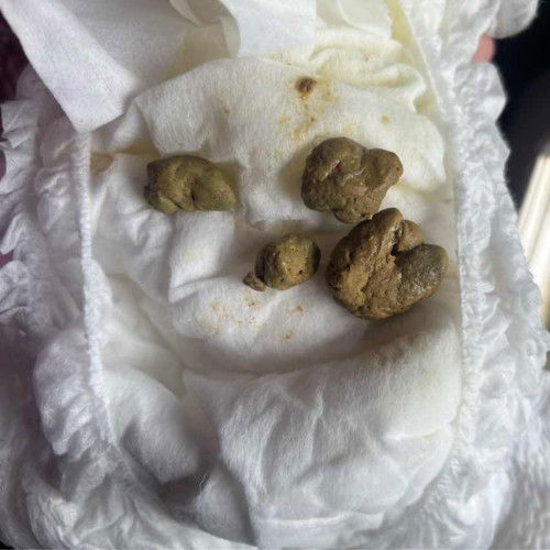 Bab keras dan kesakitan