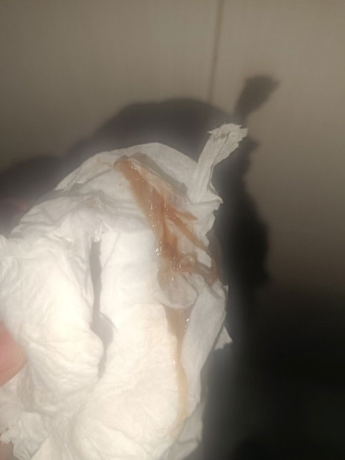 Tanda mau melahirkan kah?