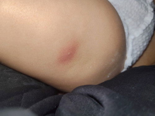 น้อง4เดือน ฉีดวัคซีนมา