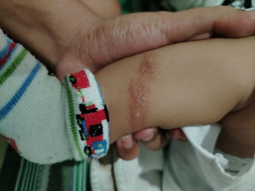 pde po magtanong ano po kaya ito salamat sa sasagot