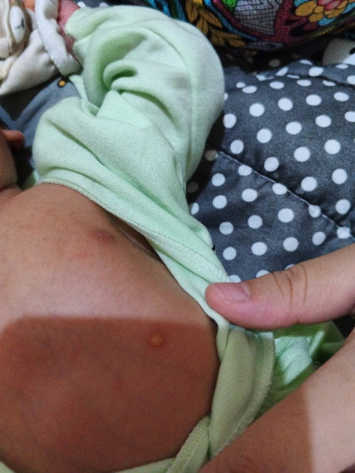 Ditubuh bayi ada melenting kenapa ya .bayi umur 23 hari