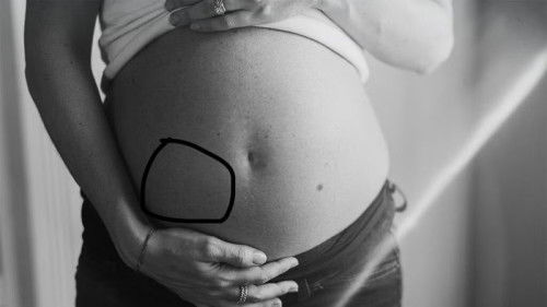 Ano po nagiging dahilan kung bakit sumasakit banda dito??